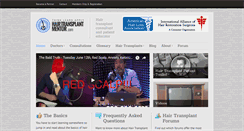 Desktop Screenshot of hairtransplantmentor.com